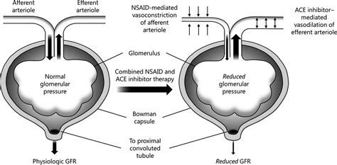 Ace Inhibitors And Kidney Disease - Captions Energy