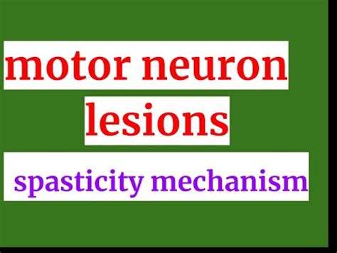 Why Does Upper Motor Neuron Lesion Cause Spasticity | Webmotor.org