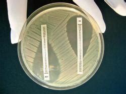 New Liofilchem MIC Test Strips