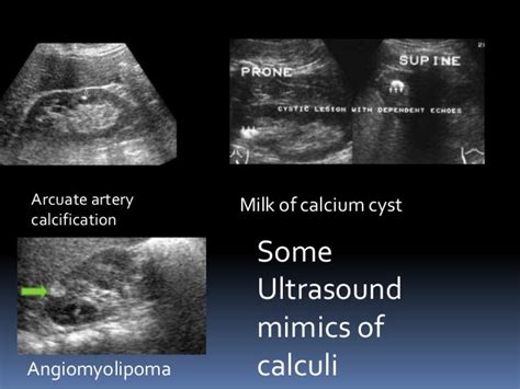 Practical tips in sonography