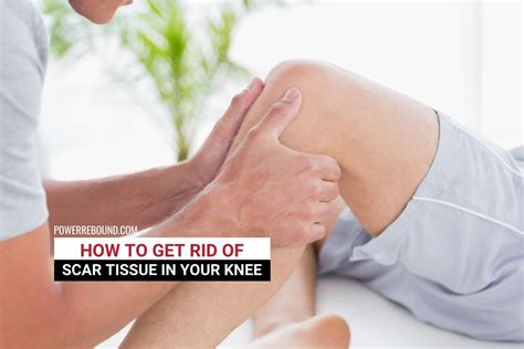 How to Get Rid of Scar Tissue in Your Knee? | Scar tissue, Getting rid ...