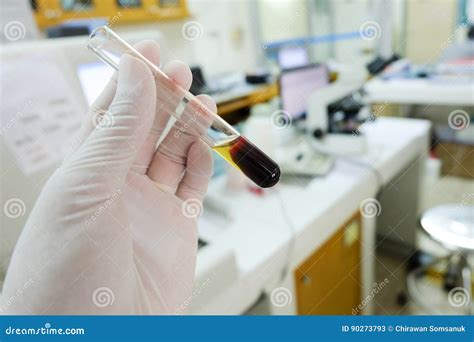 Clotted Blood with Serum in Tes Tube Stock Image - Image of chemistry, microscope: 90273793