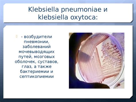 Klebsiella pneumoniae antibiotic sensitivity