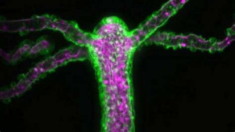 Immortal Hydra Tears Its Skin Open Every Time It Needs A Mouth | IFLScience