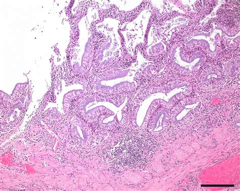 Gallbladder Labeled Histology