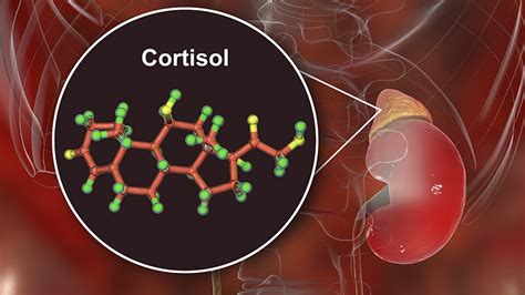 Glucocorticoid Abnormalities Boost Infections - UWINHEALTH