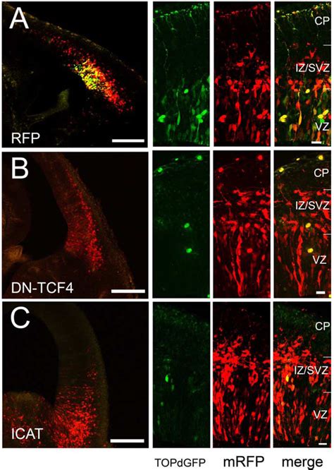 β-Catenin signaling in cortical neural precursors. β-Catenin signaling... | Download Scientific ...