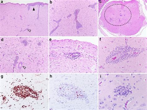 Histology of representative lesions in the nervous tissue of Muscovy... | Download Scientific ...