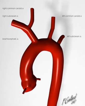 Brachiocephalic Artery