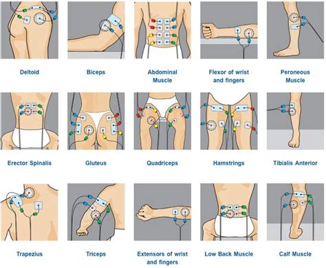 Tens Unit Placement Diagram