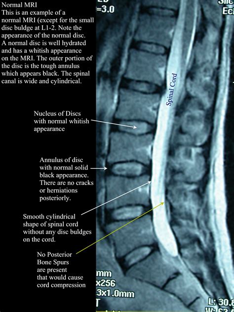 Imaging and the Lumbar Spine: What does it tell us? — AMP Healthcare ...