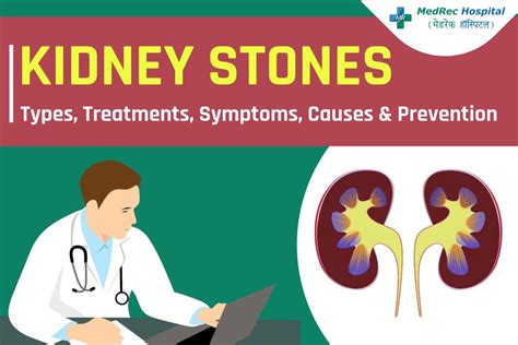 Kidney Stones Explained: Types, Treatments, Symptoms, Causes - Photo ...