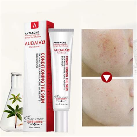 Acne Scar Remove Skin Care Acne Treatment Shrink Pores Gel Bleaching ...