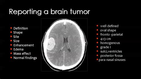 Cat Scan Brain Tumor