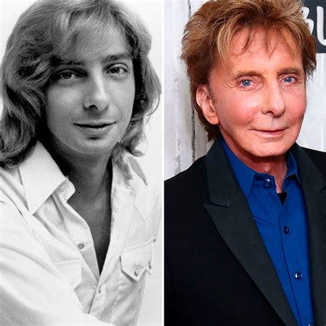 Has Barry Manilow Had Plastic Surgery? See the Singer's Transformation!