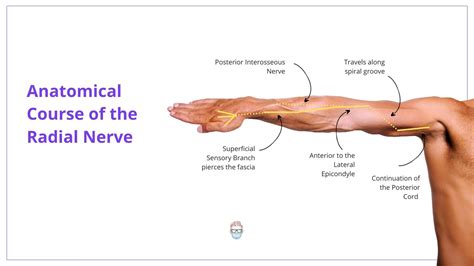 Radial Nerve Entrapment