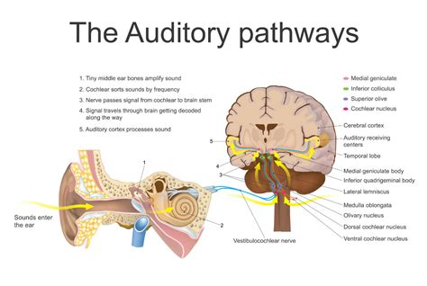 Audiology Updates: The correlation between brain health and hearing ...