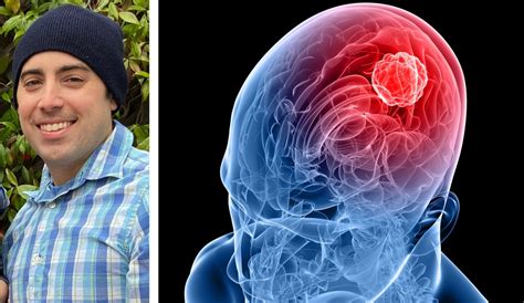 Man Survives Brain Cancer, Now His Tumor May Help Others | Vitals