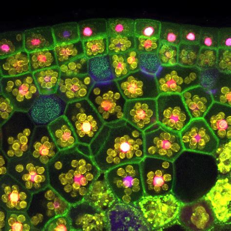 Image of stained plant tissue that was captured using a fluorescence ...