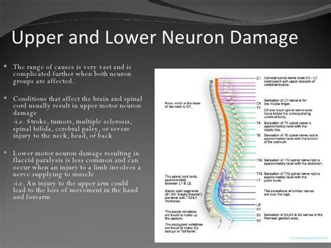 Spastic Hemiplegia; Symptoms, Diagnosis, Treatment - Health | RXharun