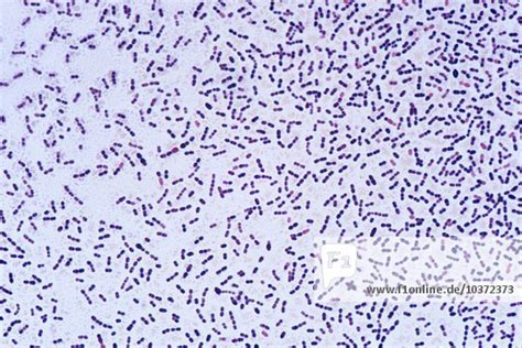 Bacteria Streptococcus ,Pneumococcus, pneumoniae, a gram-positive coccus that grows in pairs and ...