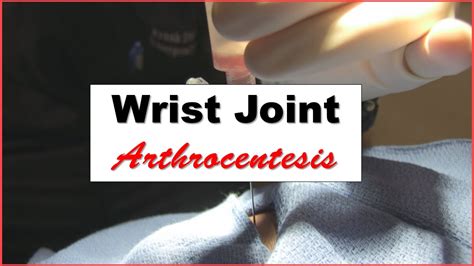 Wrist Joint Arthrocentesis Procedure - YouTube