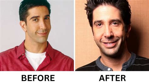 David Schwimmer Plastic Surgery: The Truth Behind the Rumors - Venture jolt