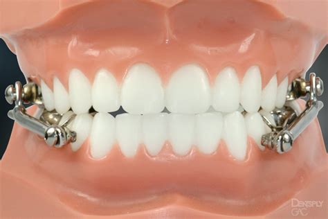 Private Orthodontic Treatments | Purely Orthodontics