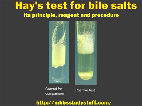 Gmelin's test for bile pigments - Its principle, reagent and procedure - Medical Study Zone