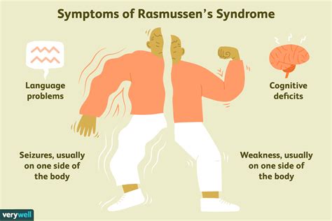 Rasmussen's Encephalitis