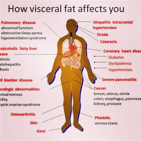 Canyon Ranch: Visceral Body Fat