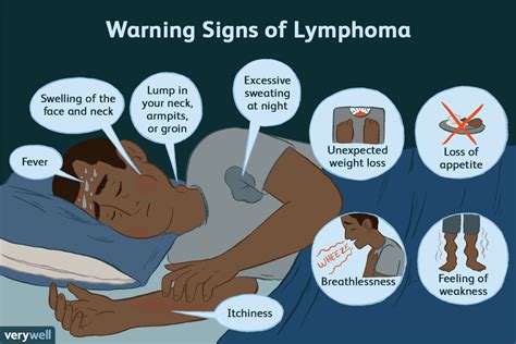 Symptoms of Lymphoma That People Often Miss | Lymphoma, Symptoms, Warning signs