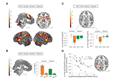 Functional MRI results for the observation of pain (v. no pain) and the... | Download High ...