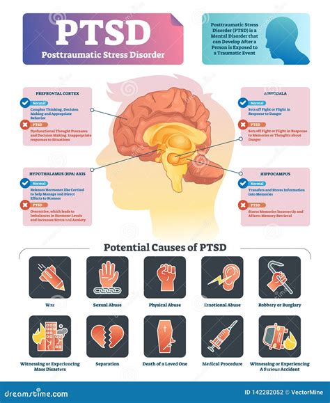 Ptsd Brain Stock Illustrations – 249 Ptsd Brain Stock Illustrations, Vectors & Clipart - Dreamstime