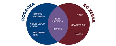 Rosacea vs Eczema: How to Tell the Difference