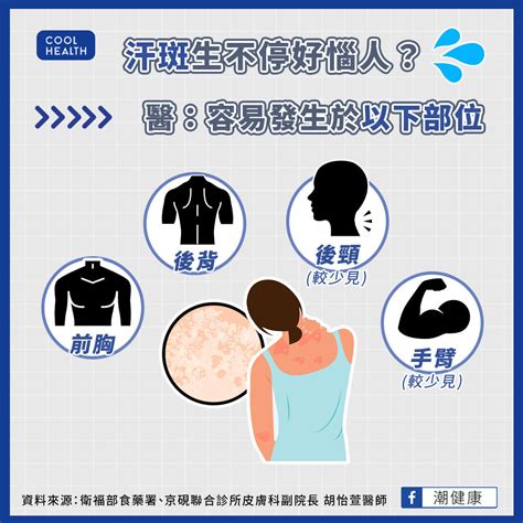 汗斑生不停好惱人？ 擦錯藥皮膚更脆弱！ 醫：認明「單方劑型」較有效 | 健康大小事 | 生活 | NOWnews今日新聞