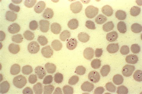 Free picture: micrograph, ring, form, plasmodium falciparum, trophozoites