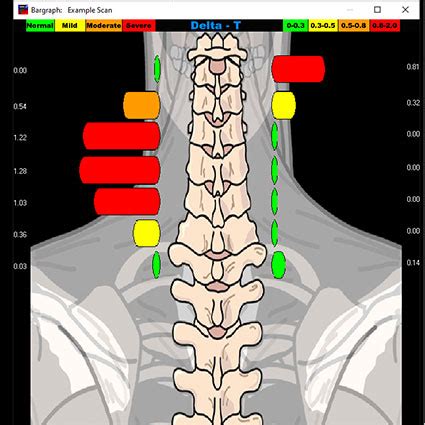 Chiropractic Adjustment Before And After