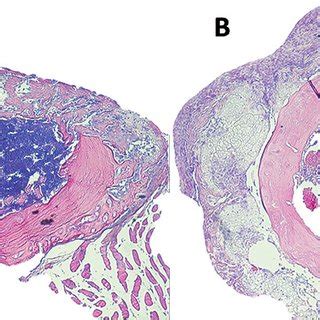 Histology images 10 days after cortical defect, 5X. Complete cortical... | Download Scientific ...