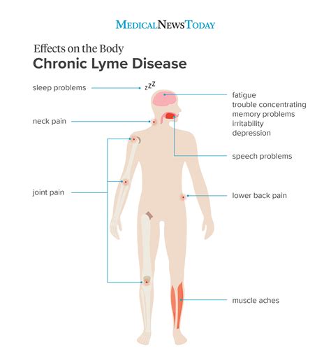 Lyme disease symptoms: Progression and when to see a doctor