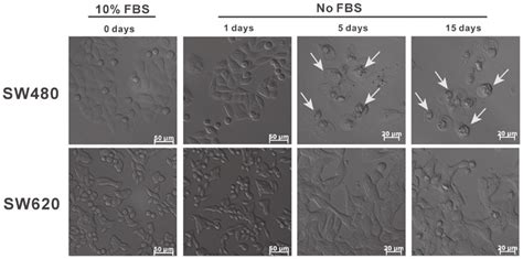 SW480 and SW620 cell morphology in a culture environment without FBS ...