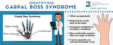 What Is Carpal Boss Syndrome and How Is It Treated?