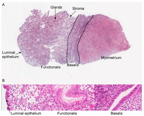 Histology Of The Human Endometrium During The Normal Cycle