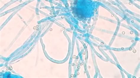 Aspergillus fumigatus Colony on SDA, LPCB tease mount under microscopy ...