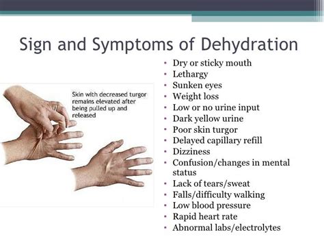 Pin by Ana Quiroz on senales de deshidratacion | Dehydration symptoms, Signs and symptoms, Symptoms