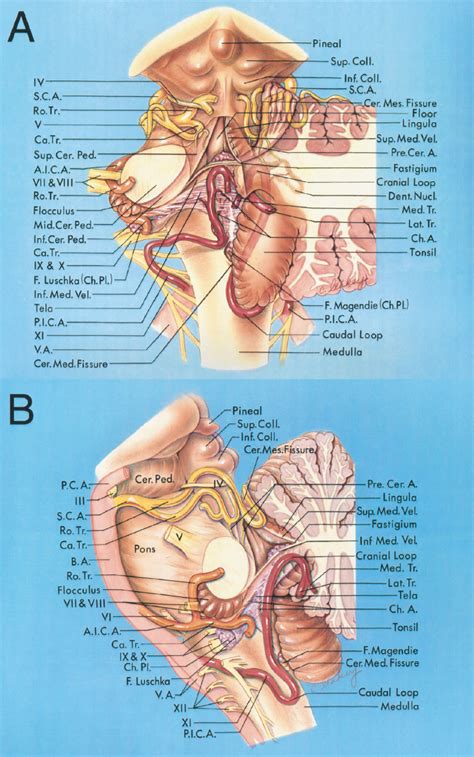 Relationships of the Cerebellar Arteries | Neuroanatomy | The ...