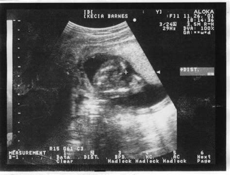 My Barnes - Ultrasound