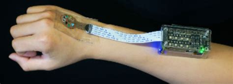 Unique light-sensing 3D-printed device could help people with lupus ...