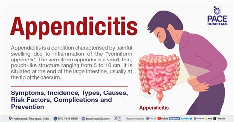 Appendicitis - Symptoms, Types, Causes, Complications, Prevention