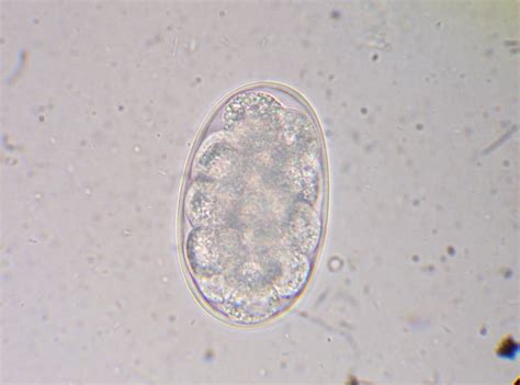 Hookworms In Dog Poop - l2sanpiero